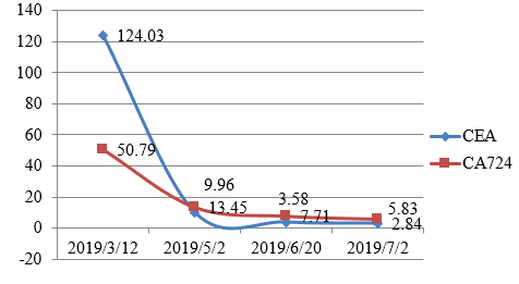 局晚期胃癌之例三：同步化放疗+PD-1抗体治疗近乎病理完全缓解