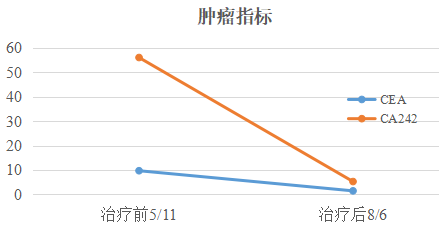 晚期胃癌伴尿毒症: Chemo-free的免疫综合治疗新模式达到明显缓解 晚期胃癌伴尿毒症: Chemo-free的免疫综合治疗新模式达到明显缓解