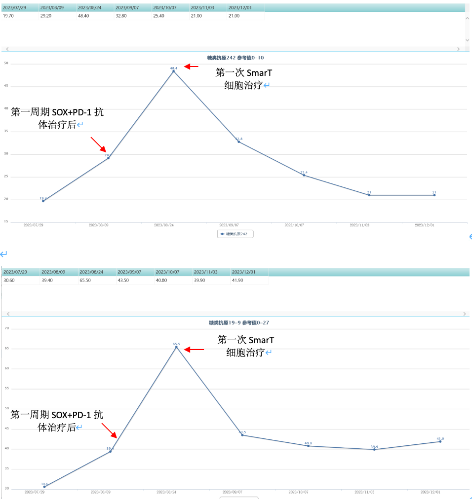 病例分享：晚期胃癌一线采用SmarT细胞联合治疗显著获益